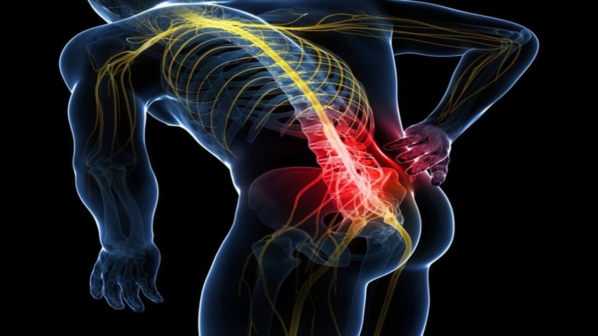 Featured image for “La Sciatalgia”